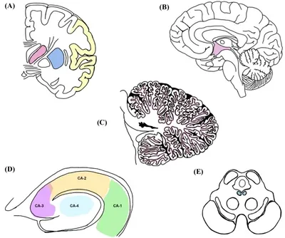Neuronal Injury Areas