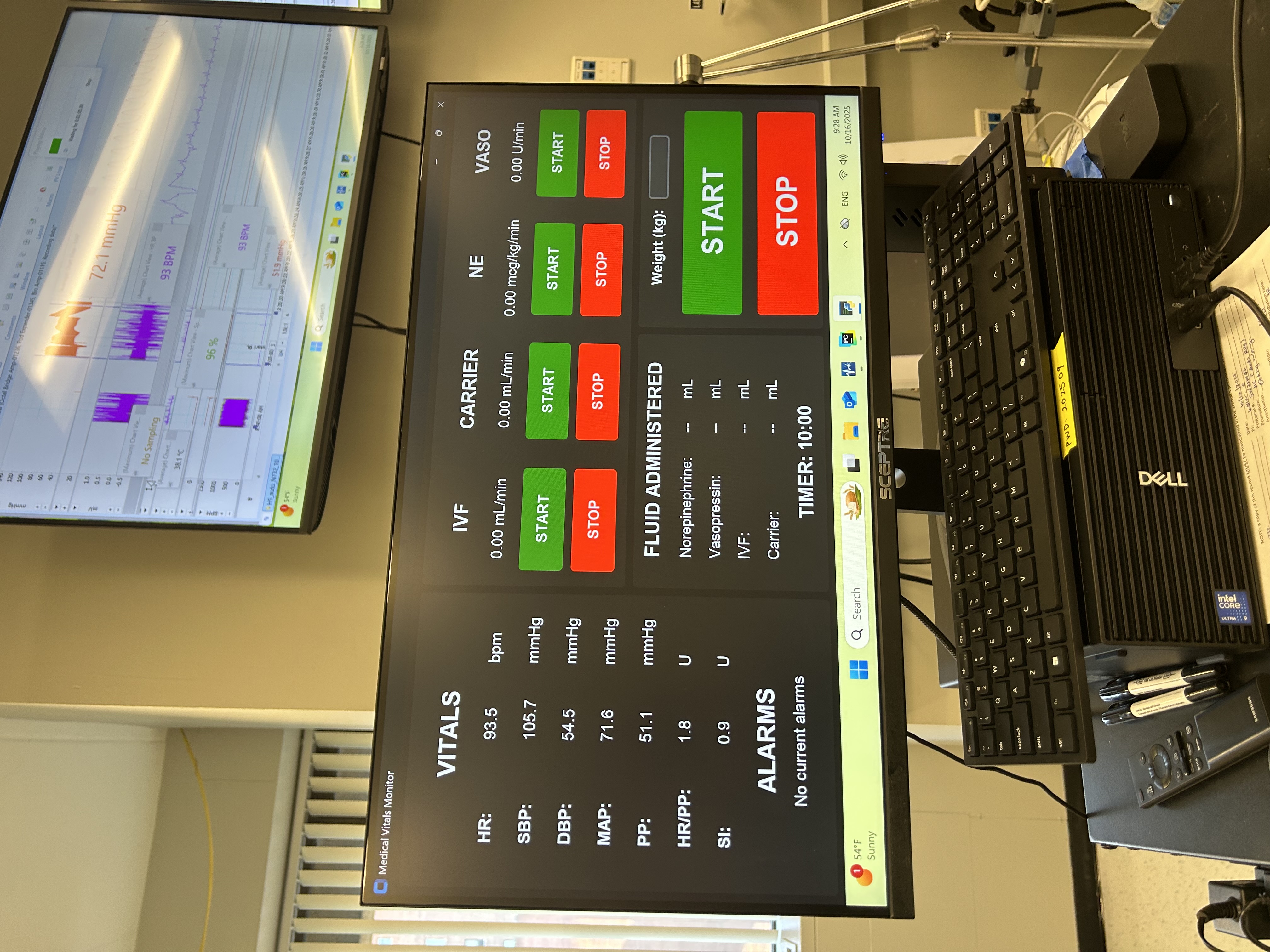 Automated Resuscitation Vitals Monitor